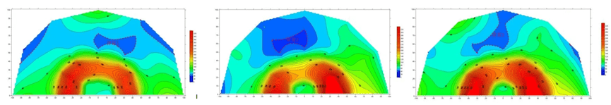 Quadrant diagram of the resistivity section of the face of the pilot tunnel